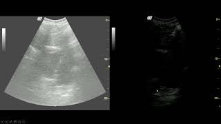 Introduction to Point of Care Ultrasound Source