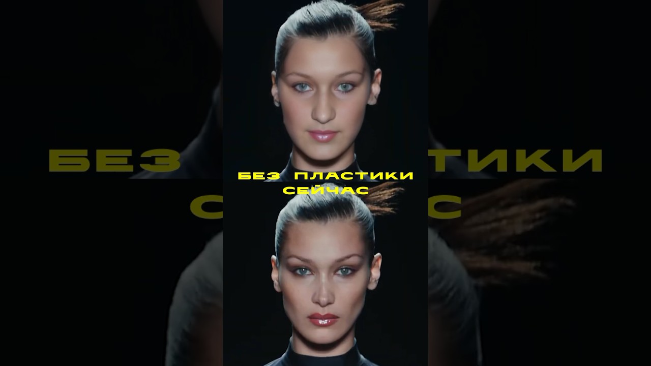 ЛИЦО БЕЛЛЫ ХАДИД БЕЗ ПЛАСТИКИ/ записаться: INST: DR.GOLOVANOV #bellahadid
