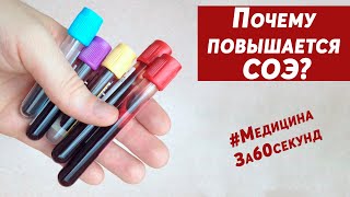 Почему повышено СОЭ ? | Причины увеличения СОЭ | Что такое СОЭ ? | Норма | #МедицинаЗа60секунд