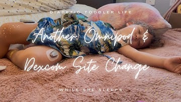 DEXCOM & OMNIPOD SITE CHANGE #type1diabetes #diabetictoddler #dexcom