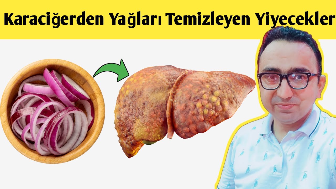 Karaciğerinizdeki Yağı HIZLA Temizleyecek 5 Yiyecek