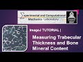 ImageJ Tutorial | Measurements of trabecular thickness, bone fraction area using threshold colors