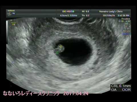 エコー動画 6週5日 17 4 24 Youtube