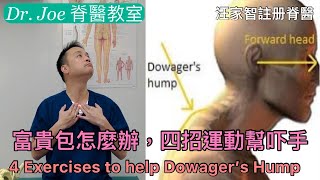 富貴包怎麼辦，四招運動幫吓手 [Eng Subtitles] 4 exercises to help Dowager’s hump