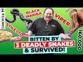 3 venomous snake bites black mamba ferdelance stiletto snakes snake milking gone wrong