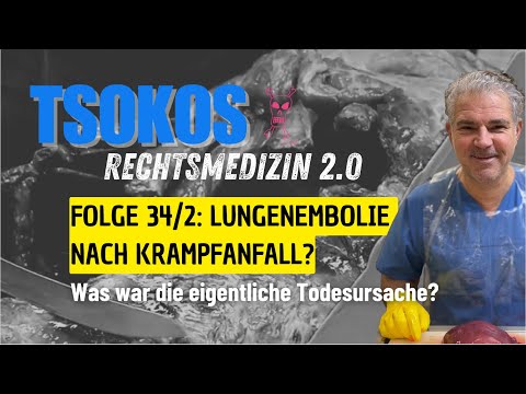 Folge 34 Teil 2: Lungenarterienembolie nach Krampfanfall: Was war die eigentliche Todesursache?