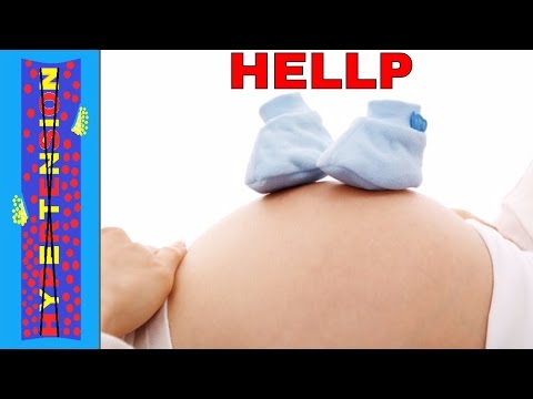 pregnancy-induced-hypertension:-gestational-hypertension-|-preeclampsia-|-eclampsia-|-hellp