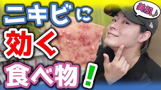 【美肌】ニキビに効く食べ物！早く治すには内側からのケアが大事！