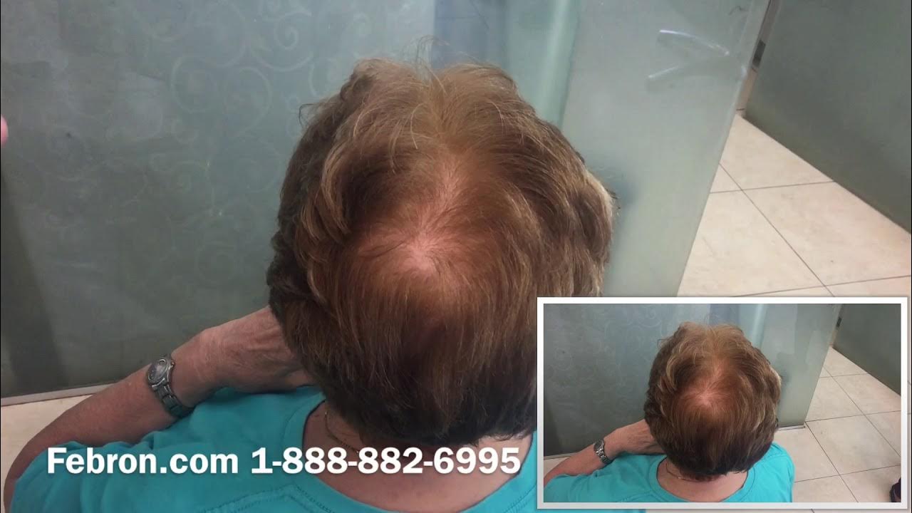 Hair building fibers best solution Febron FREE SAMPLE YouTube