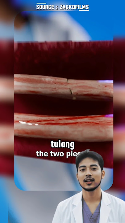 Apa yang Terjadi Saat Tulang Patah? 🤔#shorts #youtubeshort