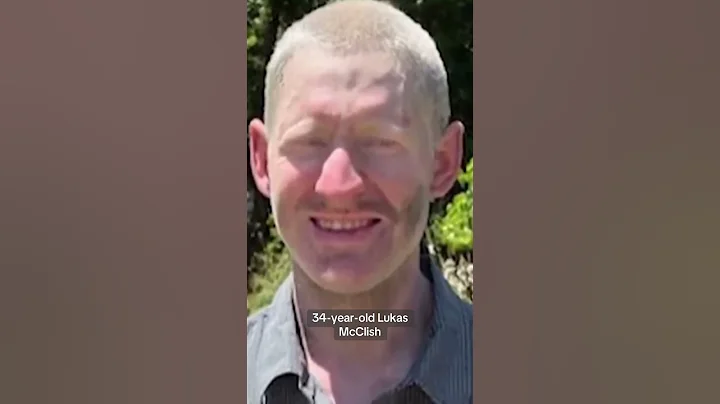 Missing hiker rescued after 10 days lost in Santa Cruz Mountains - DayDayNews
