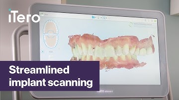 Scanning for an Implant Case with iTero Element™ intraoral scanner