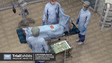 Abdominal Hysterectomy