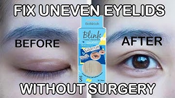 HOW TO| Fix Uneven Eyelids without Surgery | Double eyelid tutorial 👌