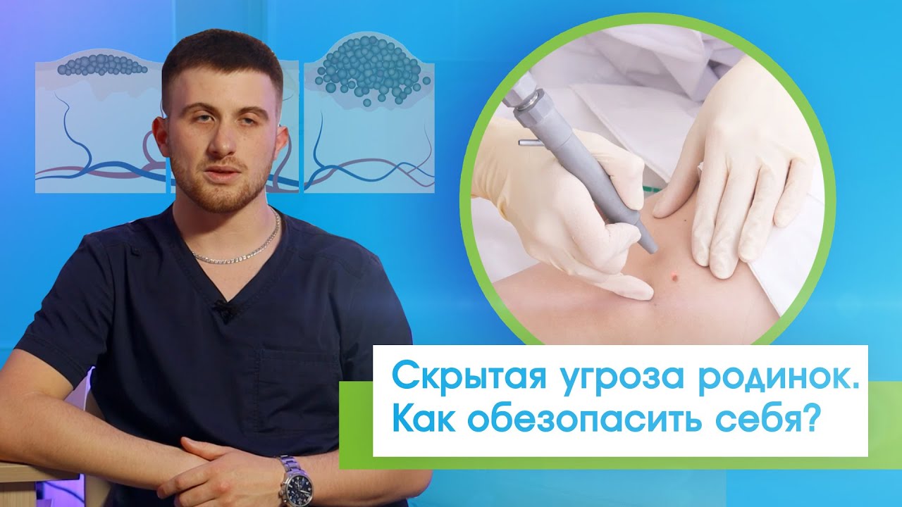 Пугающие родинки и другие новообразования. Как сделать свою жизнь безопасной и исключить рак?