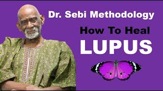 How To Heal Lupus - Dr. Sebi Methodology