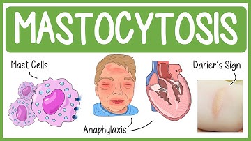 Mastocytosis Visually Explained