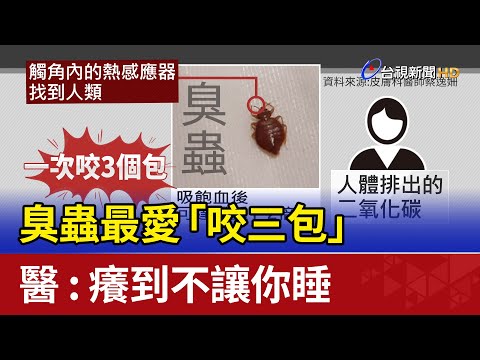 臭蟲入侵台灣！？最愛「咬三包」 醫：癢到不讓你睡