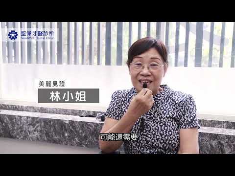 林小姐分享 治療牙痛就該找專業的聖偉林醫師 Youtube