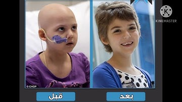 الرقية الشرعية علاج جميع انواع السرطان باذن الله