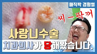 사랑니수술 치과의사가 당해보았습니다.