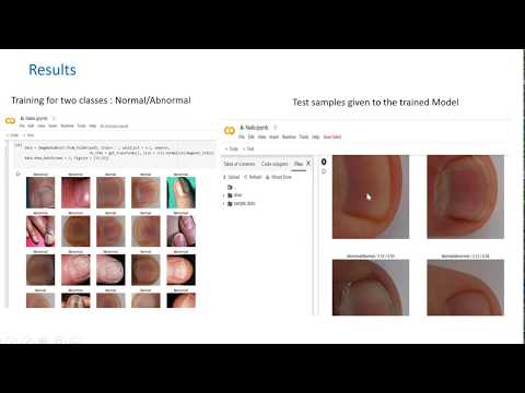 Disease Recognition through  Nails