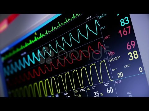 Simulated Heart Monitor