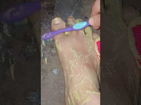 foot whitening remedy #beautyvideo #makeupinspo #beautytipsforwoman #ytshortviral