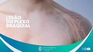 Lesões do plexo braquial: o que são, causas e tratamento | Dr. Fernando Moya CRM 112.046