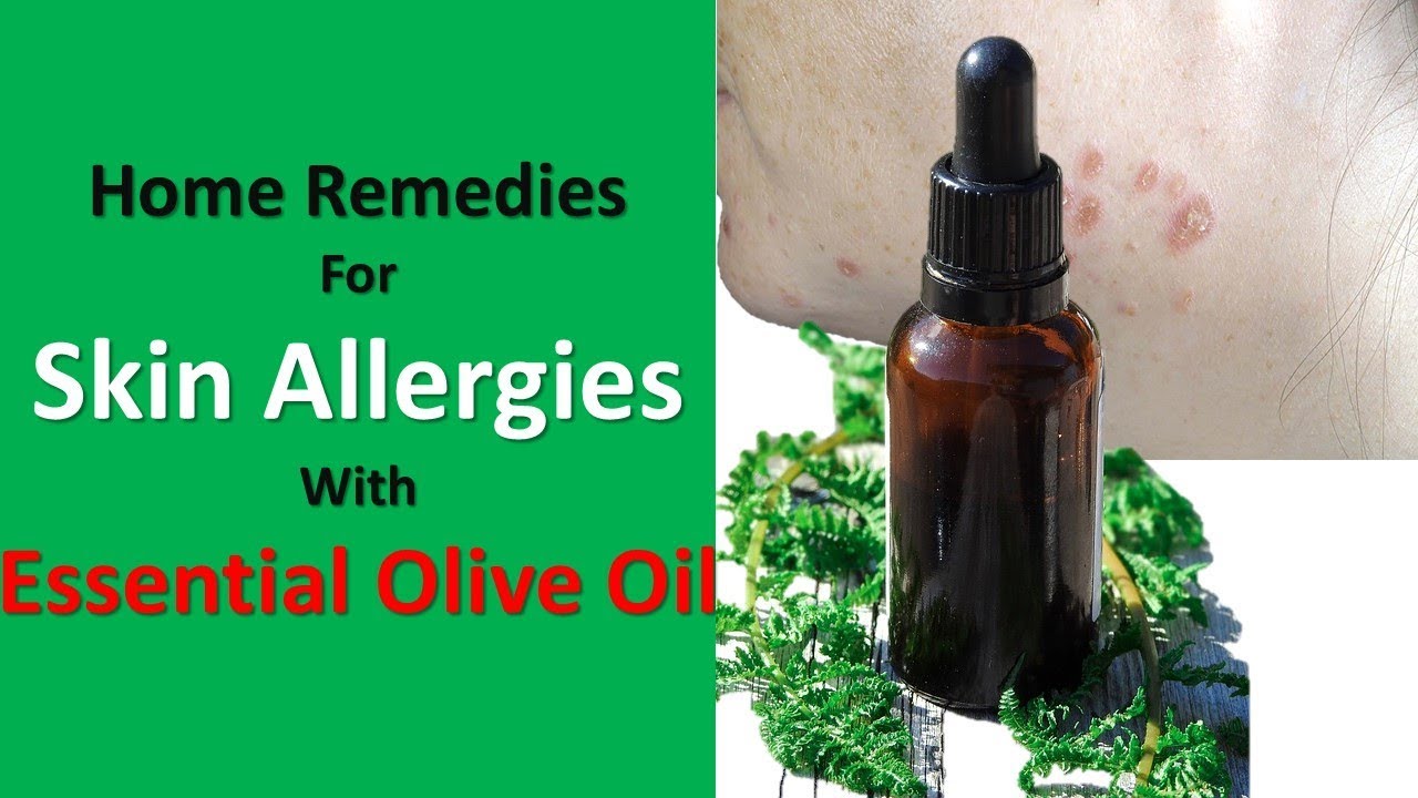 Home Remedies For Skin Allergies With Baking Soda & Essential Olive Oil