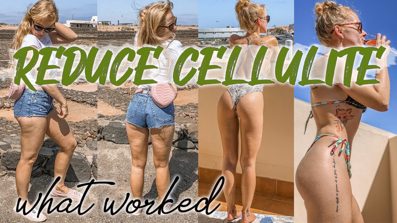 GET RID OF CELLULITE BEFORE AND AFTER 2020: reducing cellulite
