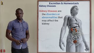 30. Kidney Diseases 1 Biology Form 2
