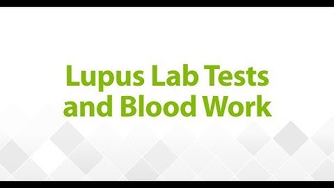 The Expert Series: Season 1, Episode 12