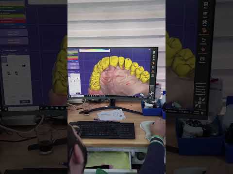 الفرق بين تقنيات صناعة الاسنان و طب الأسنان