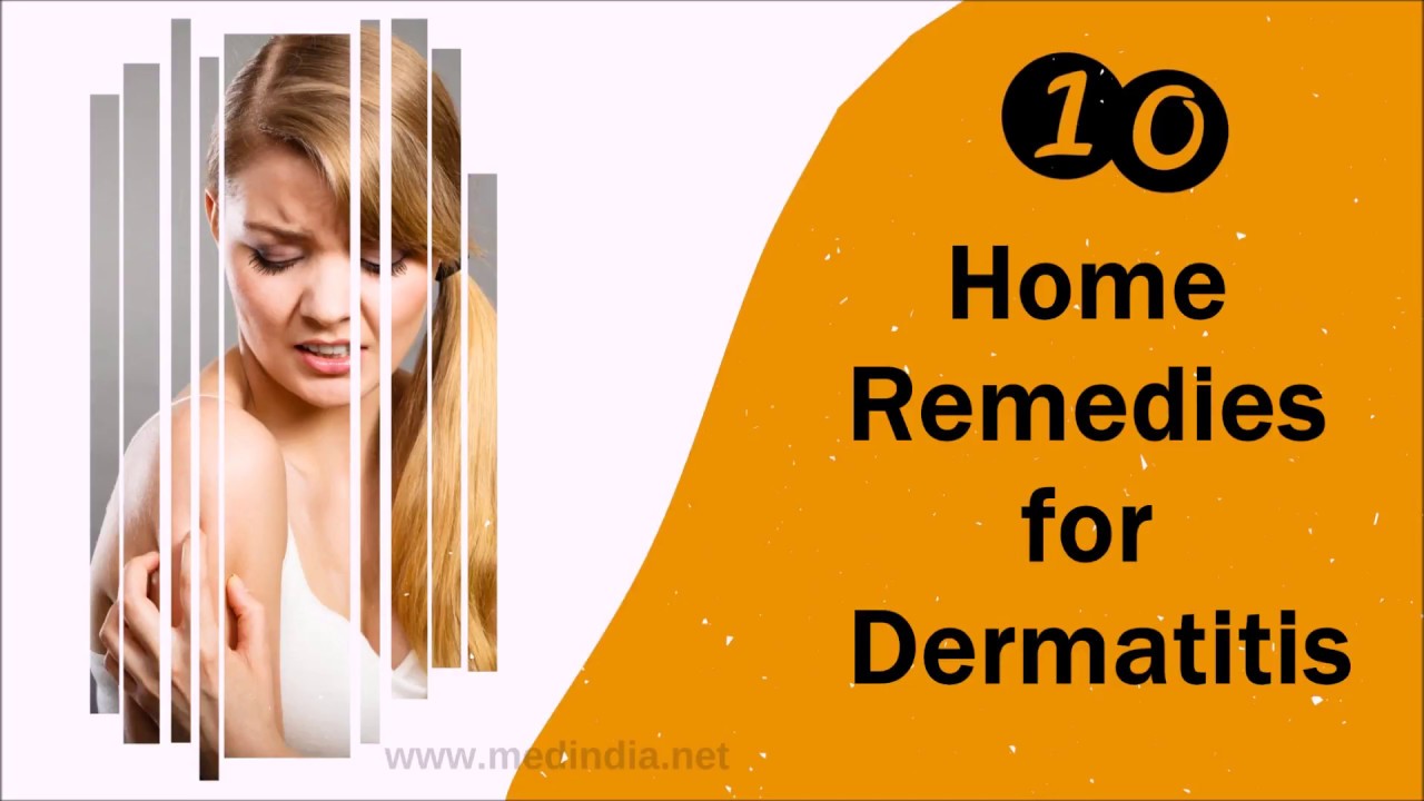 Home Remedies for Dermatitis YouTube