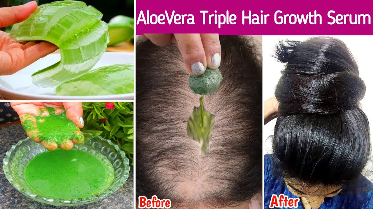 This👆🏻Aloevera Trick-Turned My Bald Hair to Thick Heavy Hair🤯- 30 Days ...