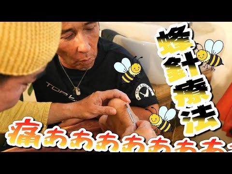 ミツバチに刺されました】大自然の中、沖縄県ヤンバルの蜂針療法！西洋