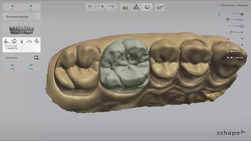 TRIOS Practice Lab   Using Anatomy Design