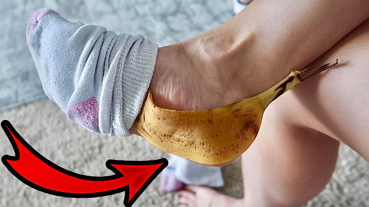 Tie a Banana Peel for 7 Days, See What Happens to Your Body 💥 (Ingenious & Surprising)