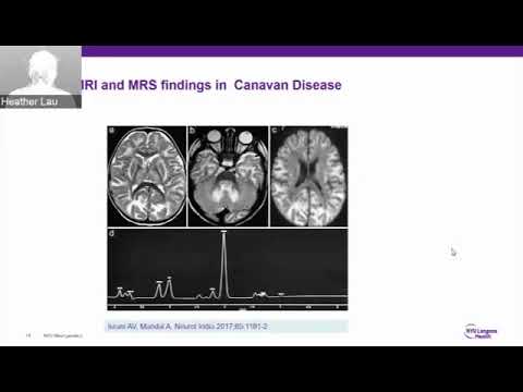 Diagnosis and Clinical Management of Canavan Disease