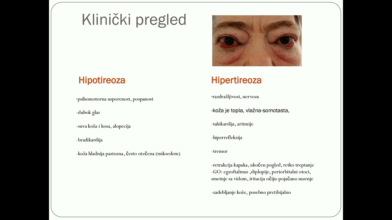 Dijagnosticke procedure u oboljenjima stitaste zlezde Biljana Nedeljkovic Beleslin   Biljana Nedeljk