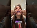 HE TAPE HER TEETH THE RESULT IS SHOCKING