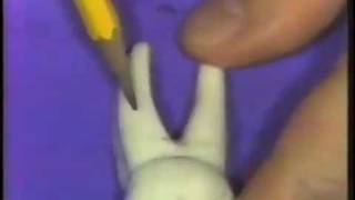 Dental Anatomy: Mandibular Molars