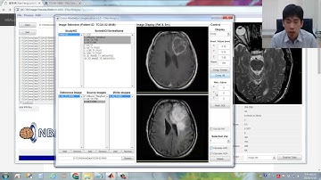 3/5 Image Coregistration and Interpolation on MRP