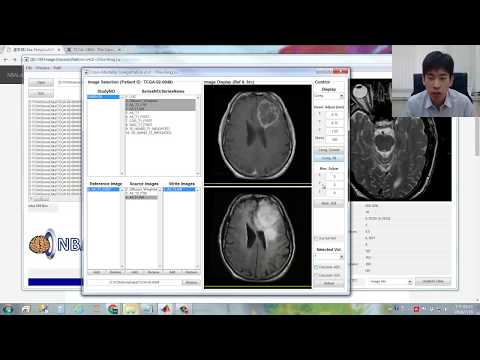 3/5 Image Coregistration and Interpolation on MRP