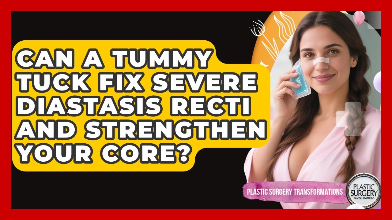 Can A Tummy Tuck Fix Severe Diastasis Recti And Strengthen Your Core?