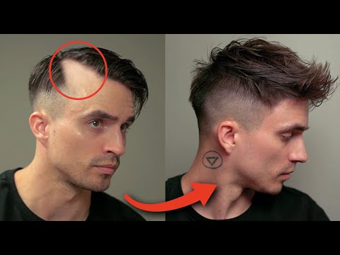 6 Brilliant Hairstyles To Hide Receding Hair & Big Foreheads - thptnganamst.edu.vn