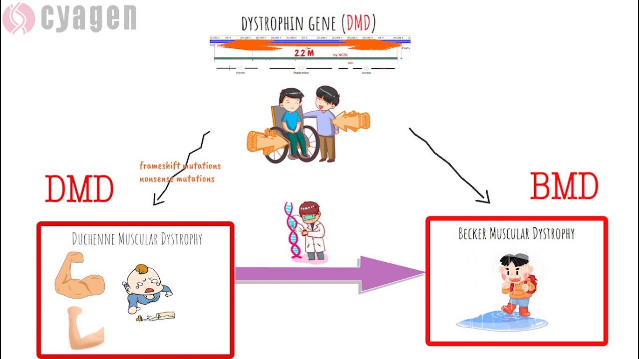DMD The Pathogenic Gene Of Duchenne Muscular Dystrophy YouTube DMD The Pathogenic Gene Of Duchenne Muscular Dystrophy YouTube