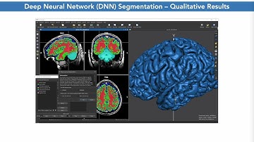 Rainer Goebel: Mesoscopic-Scale fMRI Analysis in BrainVoyager