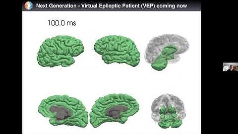 Viktor Jirsa: The Virtual Brain and EBrains